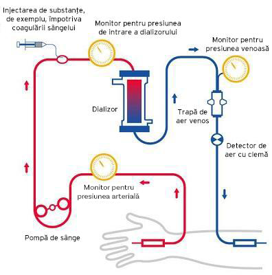 Haemodialysis_02_RO2